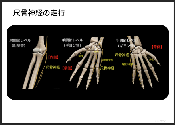 【補足情報】尺骨神経の解剖学的な走行イメージ・肘関節レベル（肘部管）・手関節レベル（ギヨン管）by リハプリント